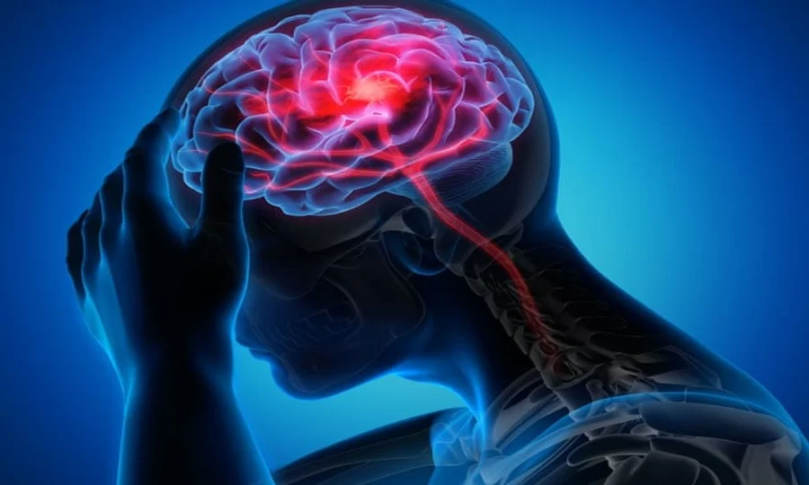 میگنیٹ فلوئیڈ انجیکشن، فالج کے علاج میں انقلابی پیش رفت