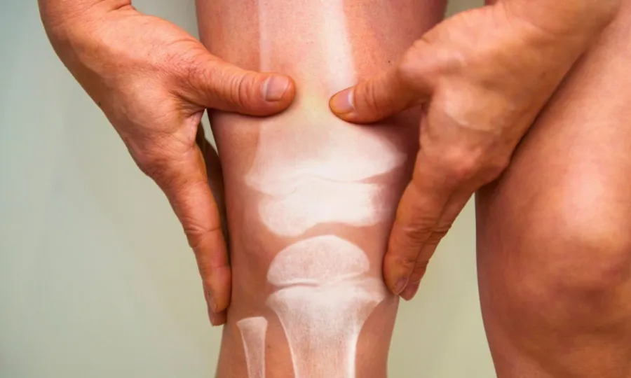 ہڈیوں کی کمزوری دماغی تنزلی کی رفتار بڑھا دیتی ہے، تحقیق